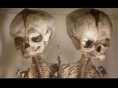 વિશ્વના 10 અદભુત મેડિકલ મ્યુઝિયમ્સ