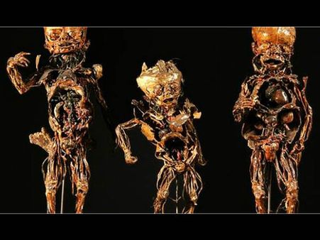 વિશ્વના 10 અદભુત મેડિકલ મ્યુઝિયમ્સ