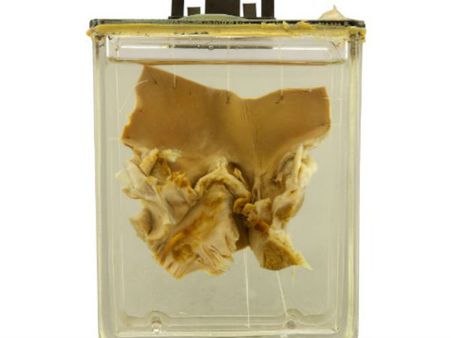 વિશ્વના 10 અદભુત મેડિકલ મ્યુઝિયમ્સ