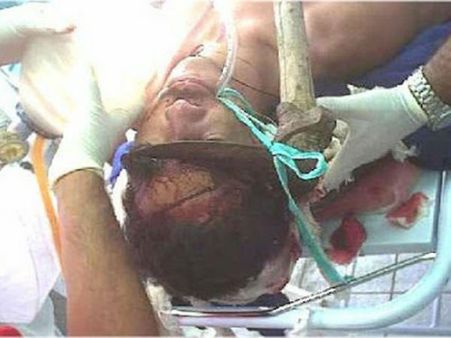 ક્રોધ અને ઇર્ષાથી પીડિતી પત્નીઓની ક્રુરતાનો શિકાર થયા પતિ