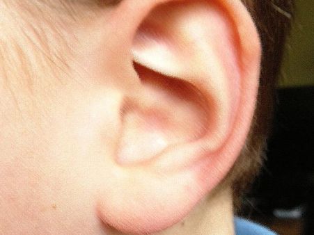 સાત વર્ષ સુધી સહન કરી આ પીડા