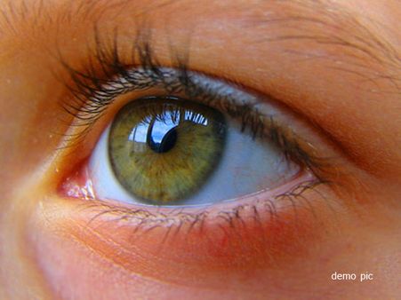 દાંતને લેન્સ લગાવી આંખમાં ફીટ કરાયો 