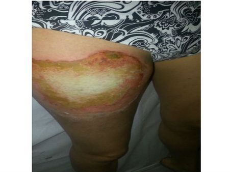 મુખ્ય કારણ જાણવામાં આવશે