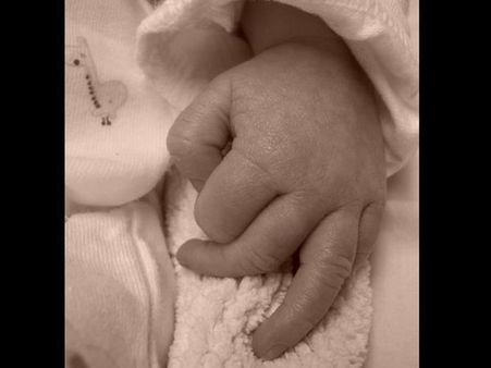 બીજુ ટેસ્ટ ટ્યૂબ બેબી ભારતમાં 