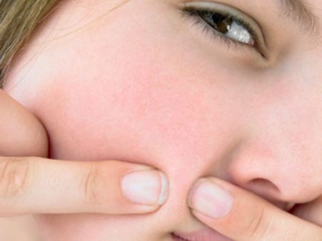 ડાબા ગાલ પર