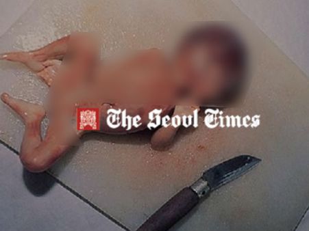 ચિકનને પણ નાખે છે સૂપમાં