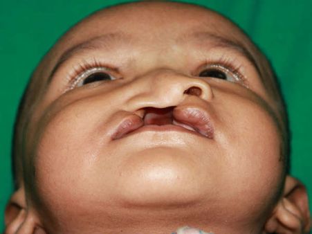  75 જેટલી સર્જરી 