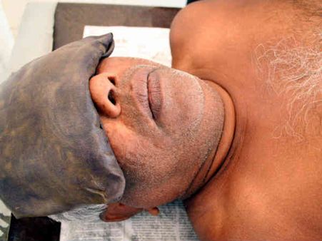 આંખો પર માટીનો લેપ 