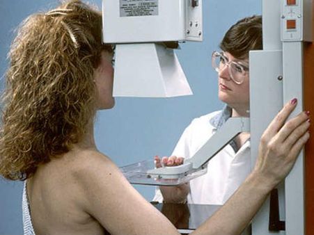 40 વર્ષની ઉપર મહિલાઓ 