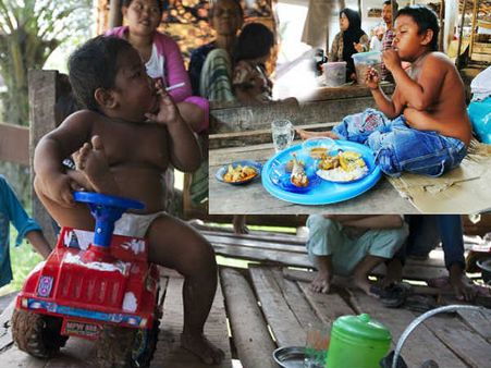 દિવસમાં 40 સિગરેટ પીનાર બાળકને લાગી ખાવાની લત, જુઓ તસવીરો