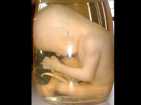 બજારમાં વેચાતા કેટલાક વિચિત્ર જનજાતીય ભોજન