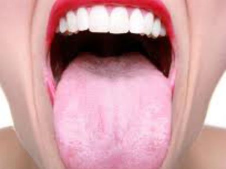 જીભનો રંગ ફિક્કો 