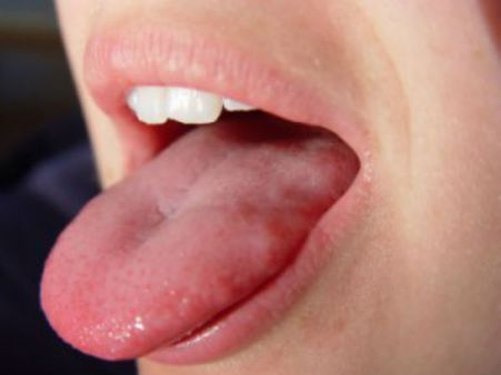 જીભની ત્વચા 