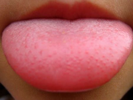 સફેદ સ્તર 