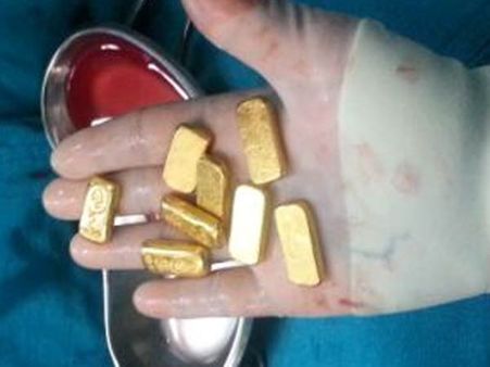 સોનુ રોકાણનું સાધન સોનુ રોકાણનું સાધન