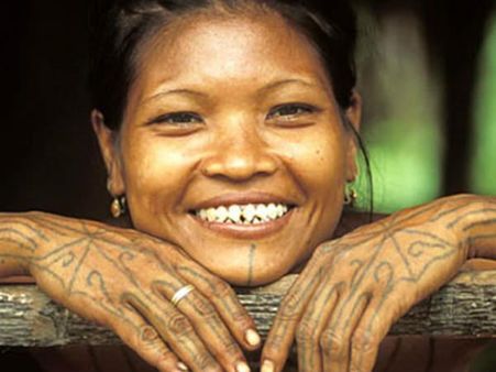 દાંત ખસવા