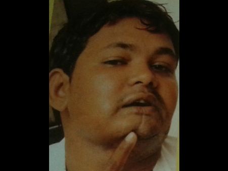 મોઢાનું કૅંસર મોઢાનું કૅંસર