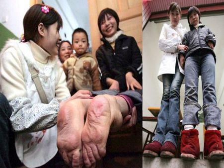 OMG! આ મહિલાના પગ જોશો તો તમે પણ ડરી જશો!