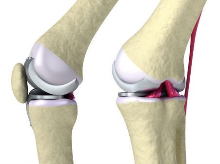 હાડકાં જીવત છે.