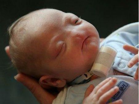 Video: સોશિયલ મીડિયા પર છવાયું નાક વગરનું બાળક