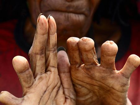 કાપી નાંખો તેને કાપી નાંખો તેને