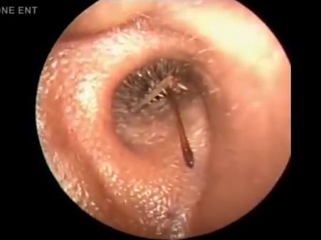 કાનમાં કંઇક હલ્યું