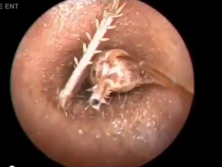 જીવતો કીડો હતો