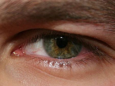 લીલી આંખ 