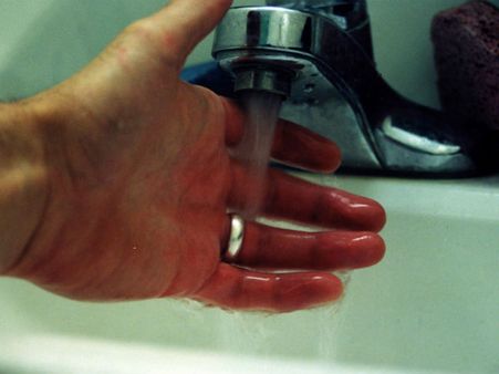 દાઝી જવું