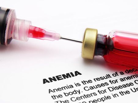 એનીમિયા