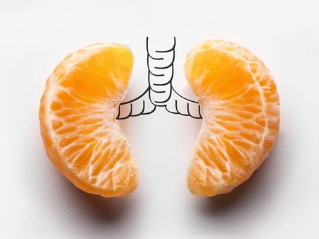 વિટામિન સીથી ભરપૂર ફૂડ