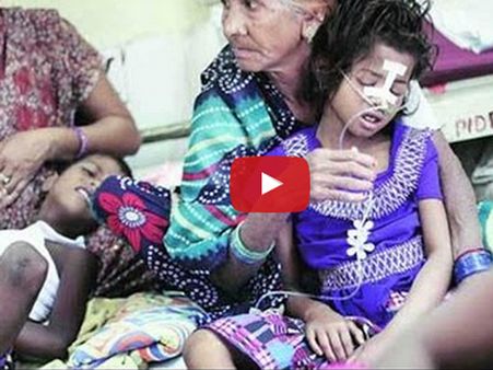 Video: અભણ માતા બાળકોના આંખોમાં દવાના સ્થાને ફેવિકોલ નાખ્યું