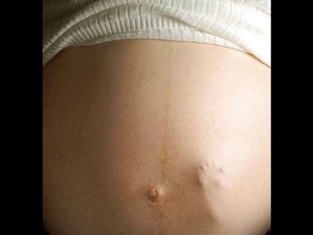 VIDEO: નહીં જોઇ હોય માંના પેટમાં અનબોર્નની આવી મસ્તી