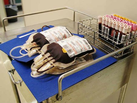 મહિલાઓના શરીરમાં ઓછુ લોહી 