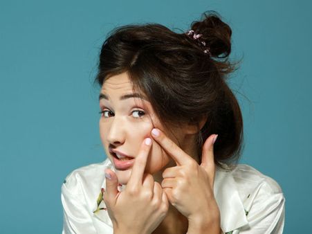 ખીલનો ઉપચાર