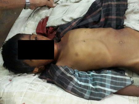 ગીરમાં 6 વર્ષના બાળક પર દિપડા કર્યો હુમલો 