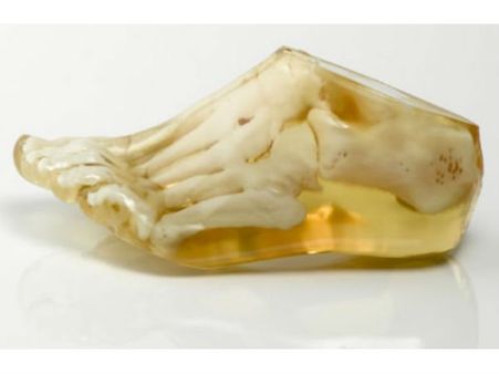 મેડિક્સ મોડલ્સ