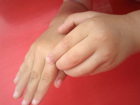 ગરમીમાં થવાવાળા રોગોથી દુર રાખે છે 