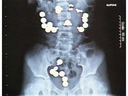 મેગનેટ મેગનેટ