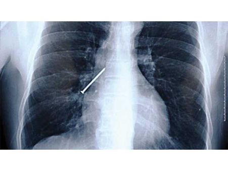 ખિલ્લી ખિલ્લી