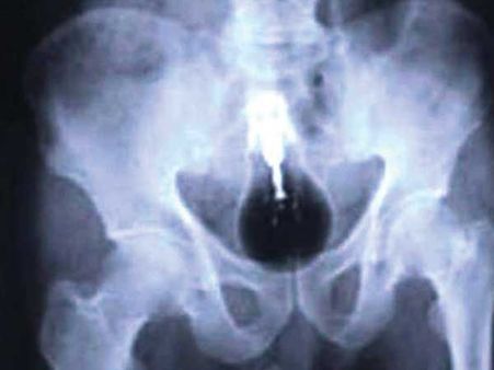 લાઇટ બ્લબ લાઇટ બ્લબ