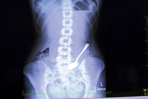 ચમચી ચમચી