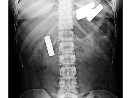 બેટરી બેટરી