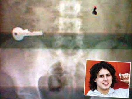 ચાવી ચાવી