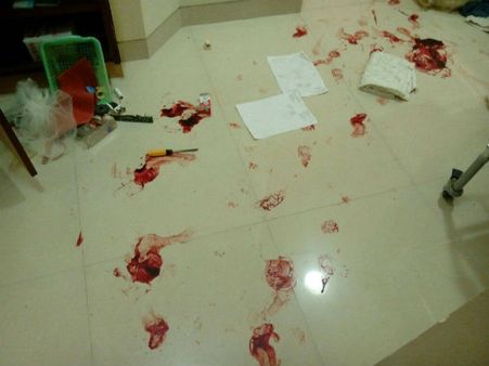 ઉમરગામમાં વૃદ્ધ મહિલાને બંધક બનાવીને લૂંટ કરી..લૂટારૂ પોતે પણ ઘવાયા