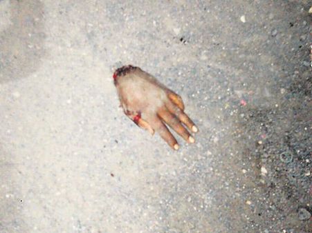 ઉનામાં ભાજપ અને કોંગ્રેસ વચ્ચે તલવારો ઉછળી એક યુવકનો પંજો કપાયો 