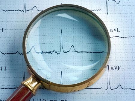 હ્યદય પર પડે છે પ્રભાવ 