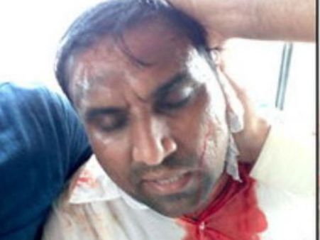 મહેસાણા, સુરતમાં પાટીદાર આંદોલન હિંસક બનતા કર્ફ્યું, નેટ સેવા બંધ