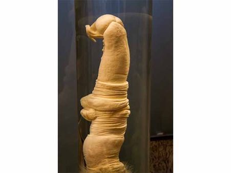 આઇસલેન્ડનું સંગ્રહાલય 