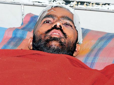 મહેસાણામાં પાટીદાર અને પોલિસના ધર્ષણમાં બ્રાહ્મણ યુવાન વાંક વગર પીસાયો!